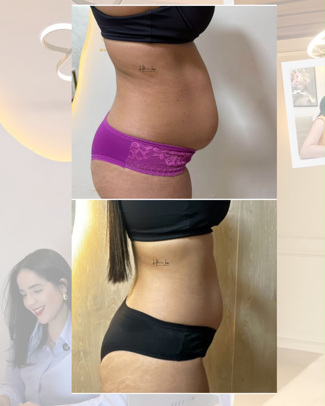 Resultado 2 · montagem de antes e depois