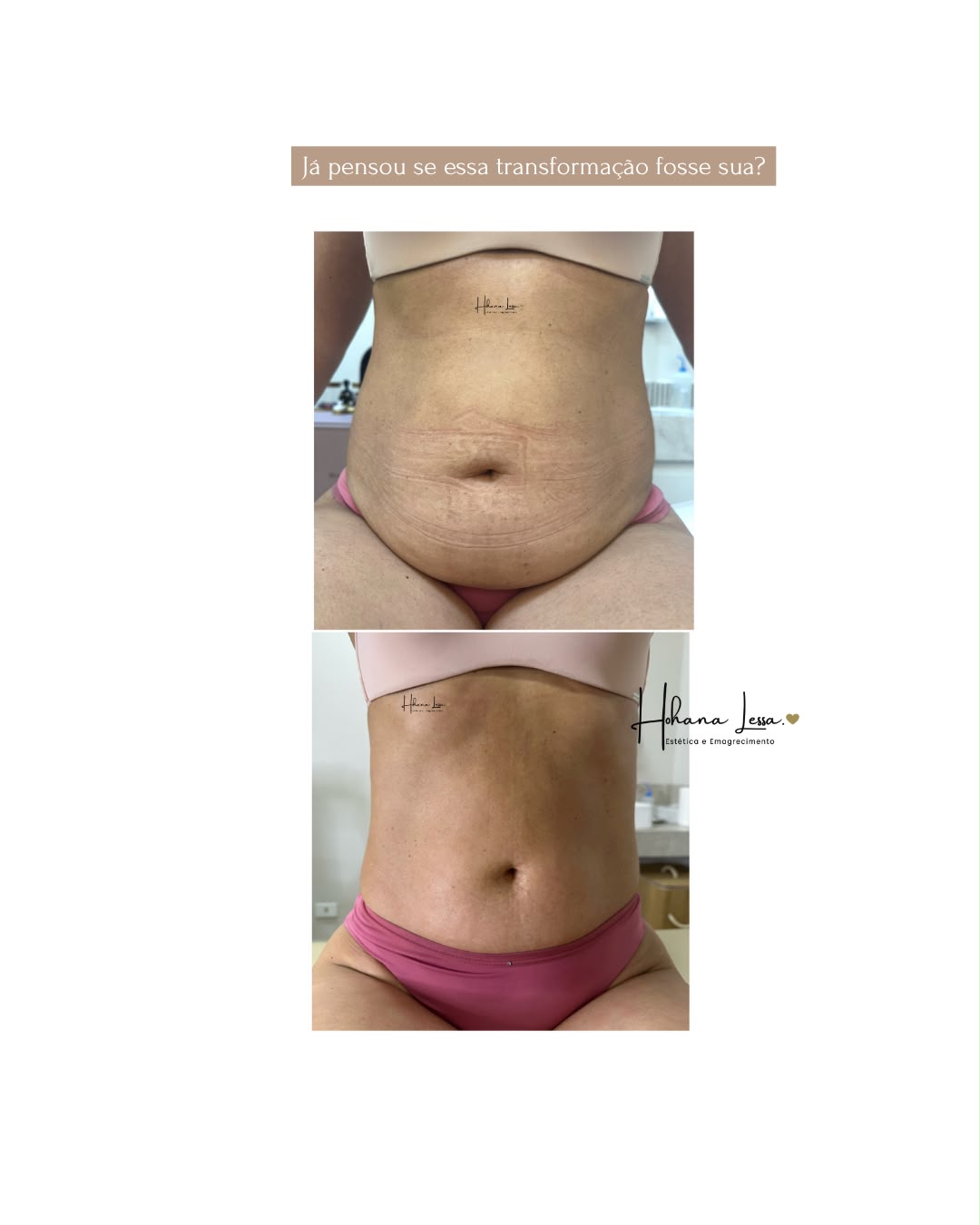 Resultado 5 · montagem de antes e depois
