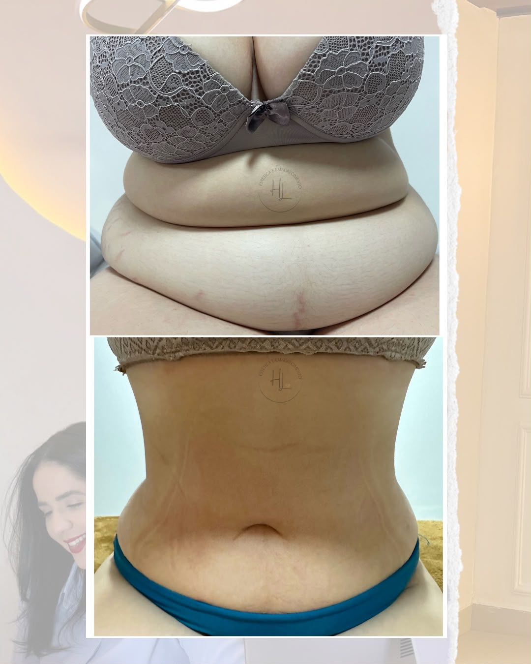Resultado 6 · montagem de antes e depois