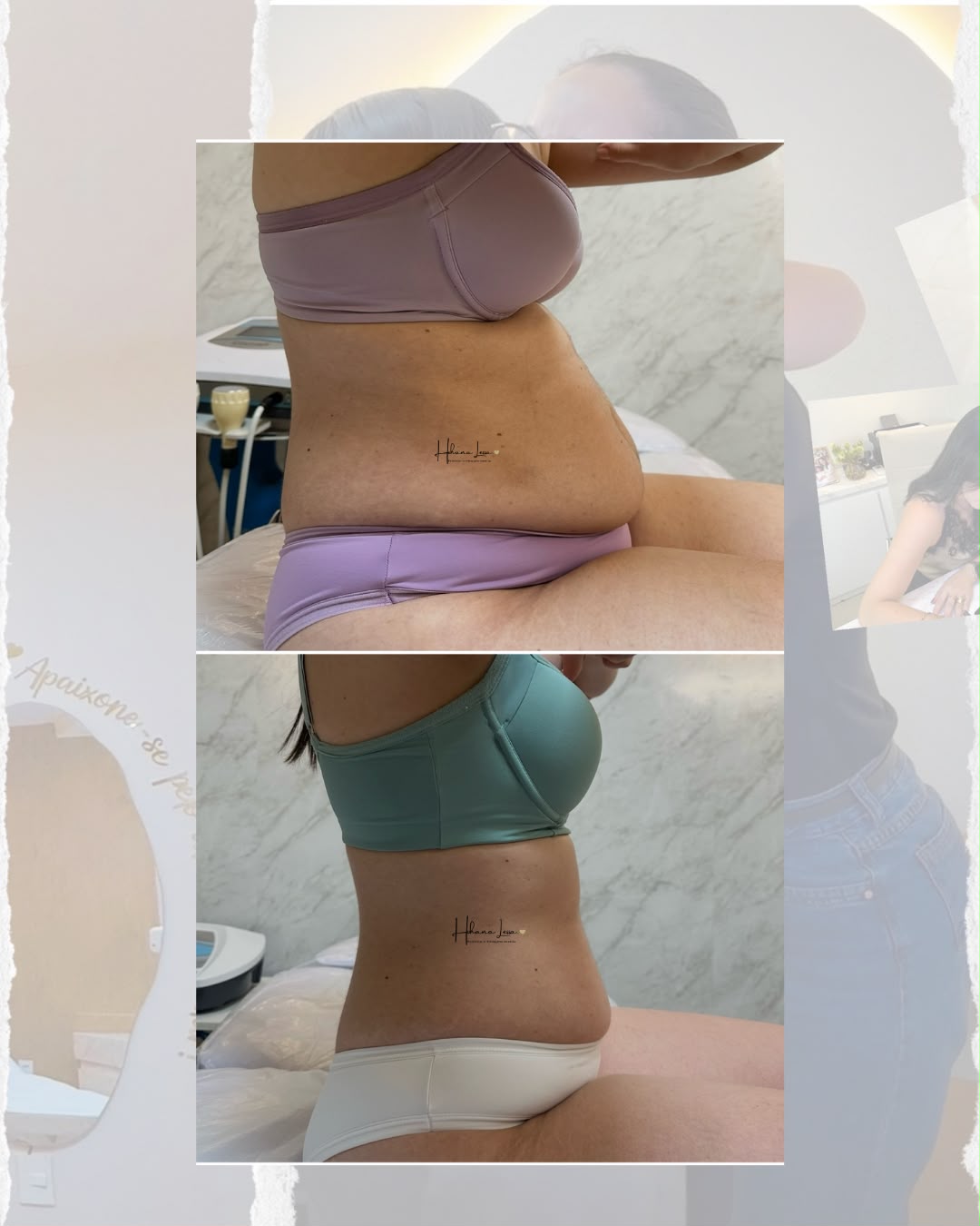 Resultado 1 · montagem de antes e depois
