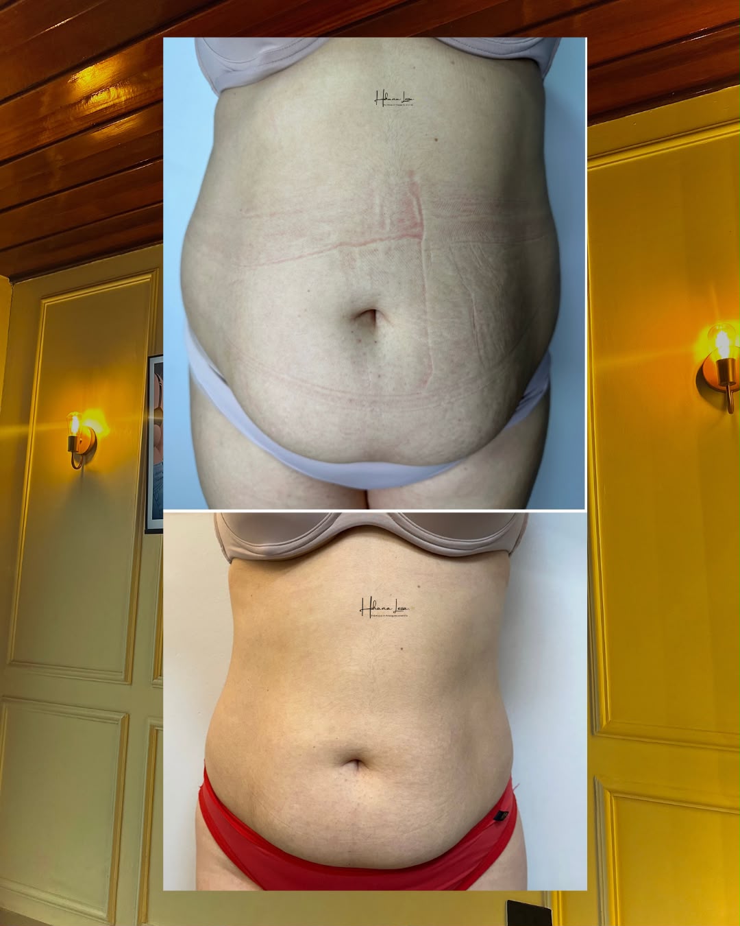 Resultado 3 · montagem de antes e depois